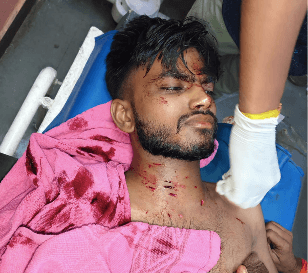 मंदसौर: सरप्राइज गिफ्ट के बहाने पत्नी ने किया पति पर जानलेवा हमला; कैंची और चाकू से हमला