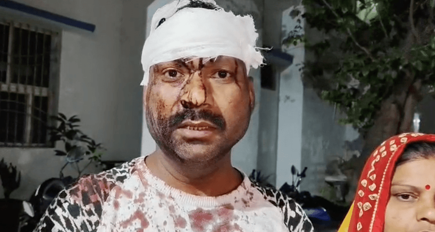 ग्वालियर: गाड़ी खड़ी करने को लेकर पड़ोसियों में विवाद; लाठी-डंडों से हमला