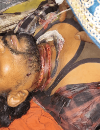 ग्वालियर में बहन को लेने आए भाई पर जानलेवा हमला, दो आरोपी गिरफ्तार