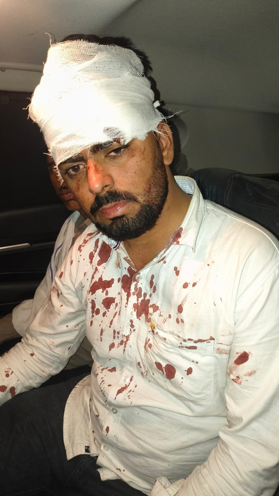 डबरा: बारात में विवाद के बाद फायरिंग, घायल युवक के सिर में आए 14 टांके