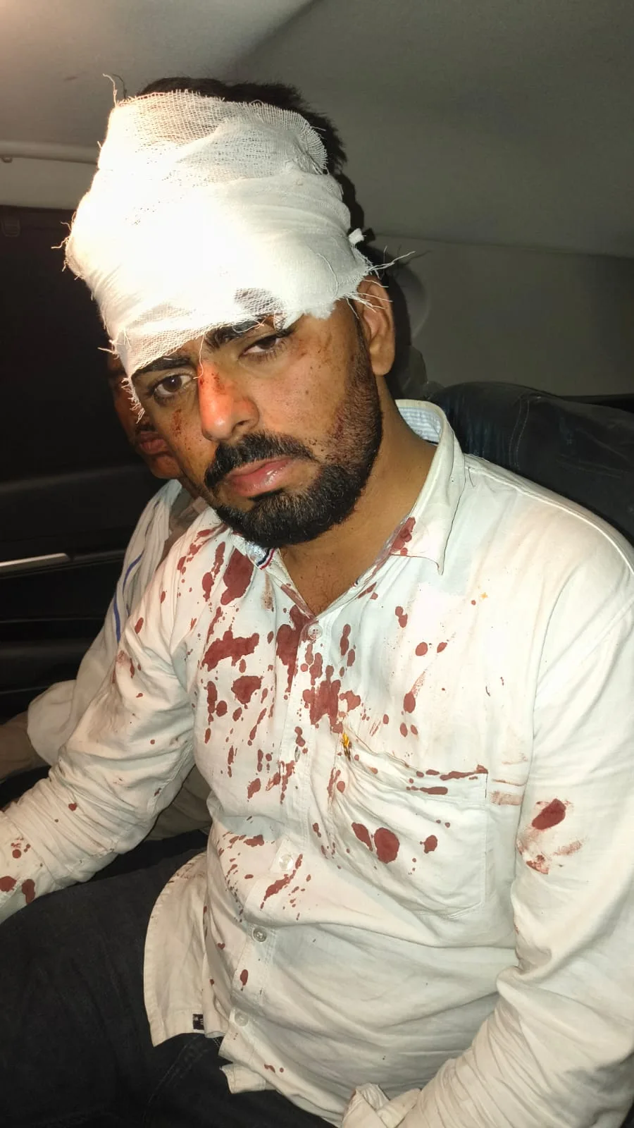 डबरा: बारात में विवाद के बाद फायरिंग, घायल युवक के सिर में आए 14 टांके