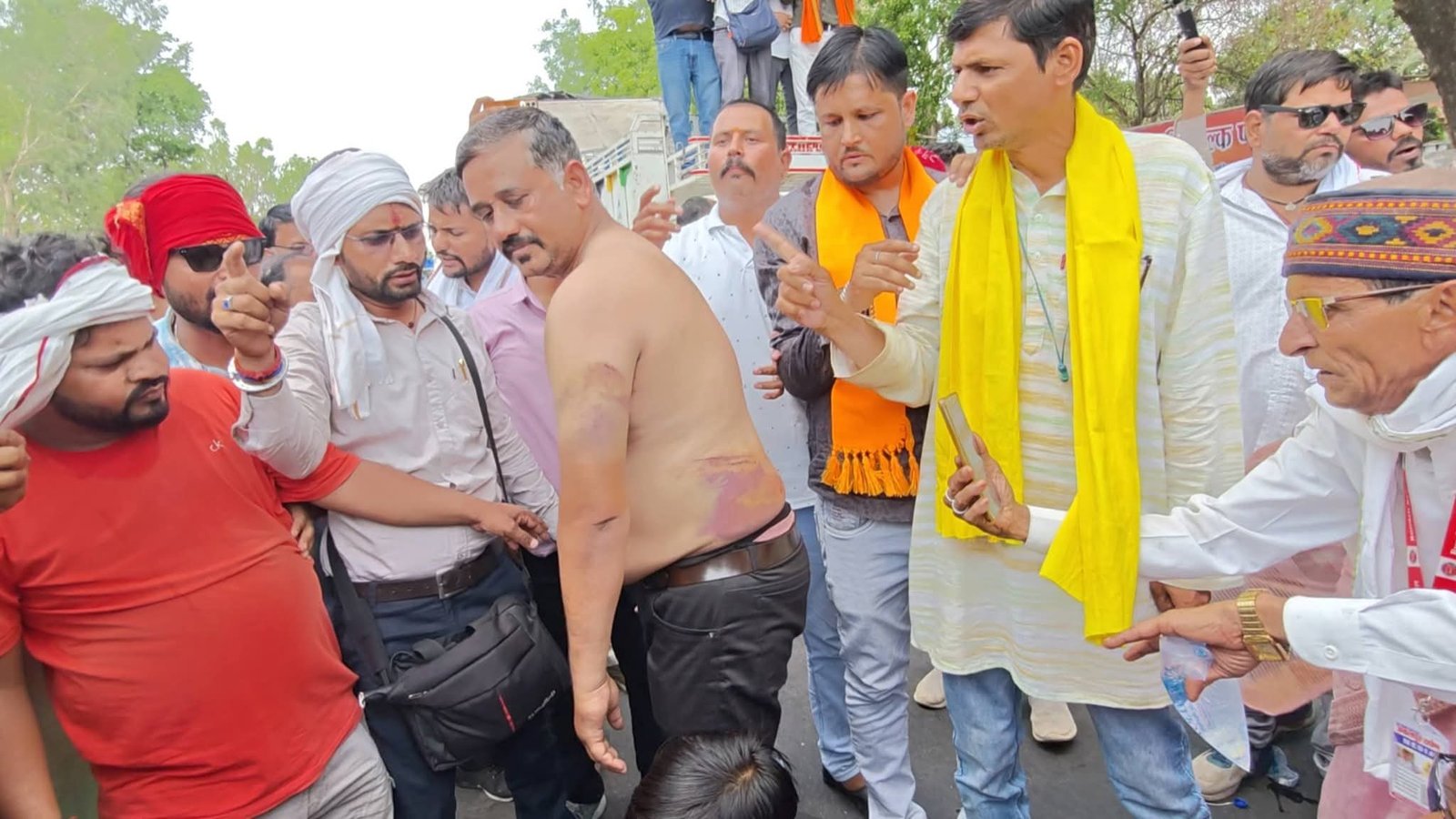 छतरपुर में पत्रकारों का प्रदर्शन: राकेश राय हमले के विरोध में सड़क पर उतरे, एसपी कार्यालय के बाहर चक्का जाम