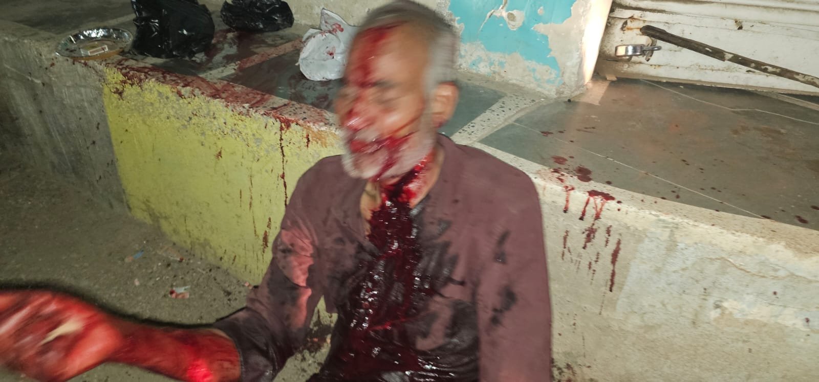 ग्वालियर: पुरानी सब्जी मंडी में नशे में खूनी संघर्ष, युवक पर ब्लेड से हमला, हालत गंभीर