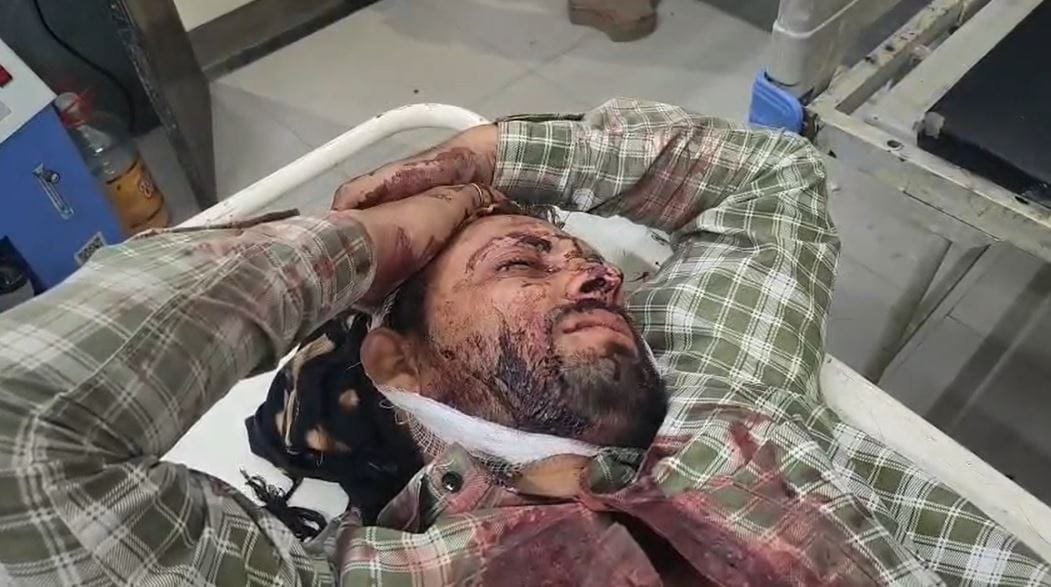 पीथमपुर में शराब पीकर युवकों का हंगामा; दो पक्षों में जमकर मारपीट, गंभीर चोट के चलते इंदौर रेफर