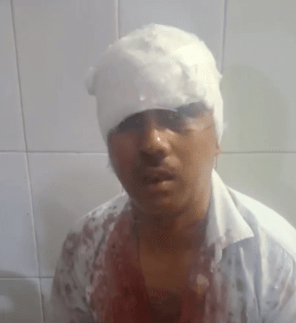 महराजगंज में स्वर्ण व्यवसायी से लूट का प्रयास, 6 बदमाशों ने घेरकर हमला; लाखों के जेवरात लेकर फरार