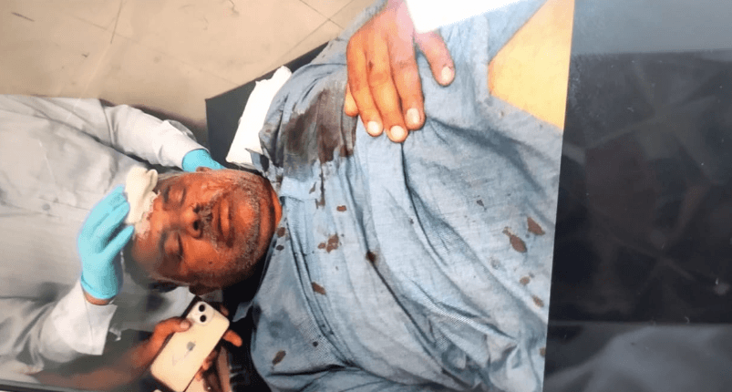 थाटीपुर में सरेराह गुंडागर्दी! पड़ोसी से चल रही रंजिश में युवक को मारी गोली, वारदात के बाद पिस्तौल लहराते बदमाश फरार