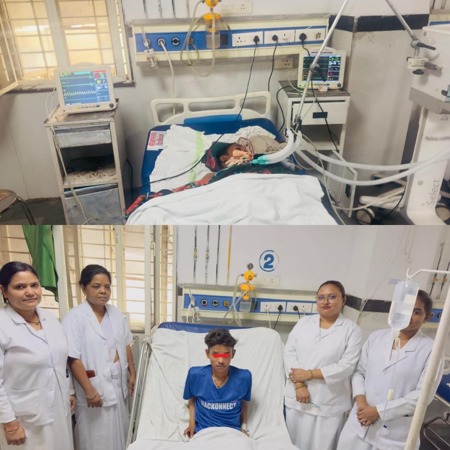 छतरपुर जिला अस्पताल की बड़ी सफलता: वेंटिलेटर पर भर्ती सर्पदंश मरीज की बचाई जान